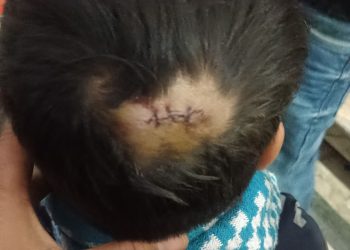 Badaun : शहर के नामचीन मॉल में नववर्ष 2026 पर हुई अव्यवस्थाओं की पार्टी में बच्चा घायल