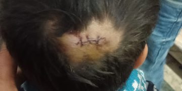 Badaun : शहर के नामचीन मॉल में नववर्ष 2026 पर हुई अव्यवस्थाओं की पार्टी में बच्चा घायल