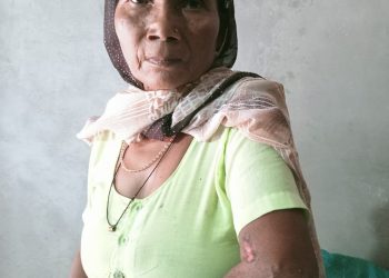 वजीरगंज में ऊंचे ब्रेकर से उछलकर बाइक सवार आशा कार्यकर्ता गिरी, घायल