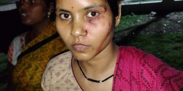 पिता को तालिबानी सजा के विरोध में दी तहरीर तो बेटी पर किया हमला, जमकर पीटा